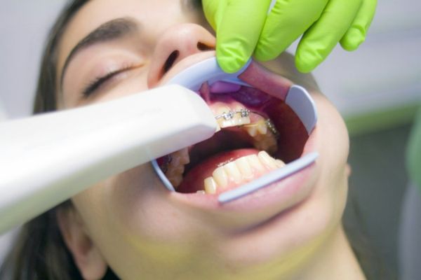 Periodontics & Endodontics in Thornhill